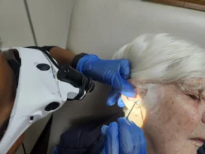 Earwax Removal in Bethnal Green | Complete Guide to Microsuction